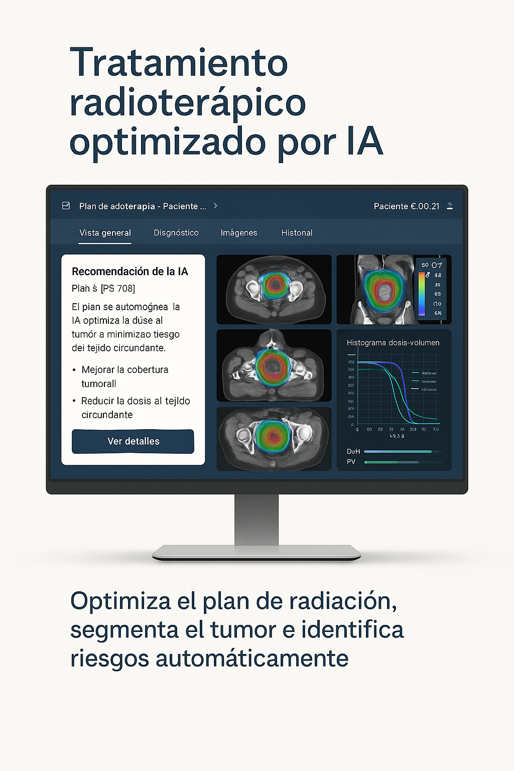 Mockup IA en Oncología Radioterápica
